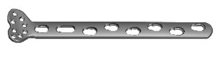 Дистальна задня променева блокуюча пластина ІV